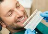 Do I Really Need Dental Veneers? Dental Veneers