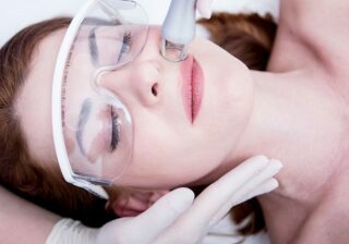 Understanding Common Laser Skincare Treatments